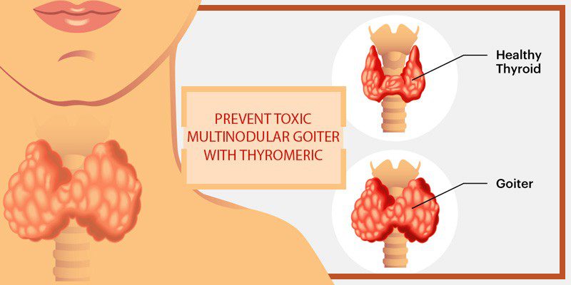 Thyromeric for Goiter cure Toxic Multinodular Goiter , , turmeric benefits