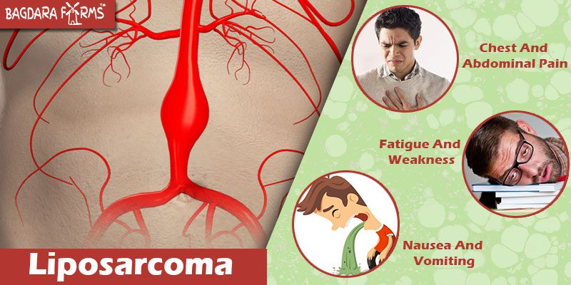 Liposarcoma cure with Oncomin