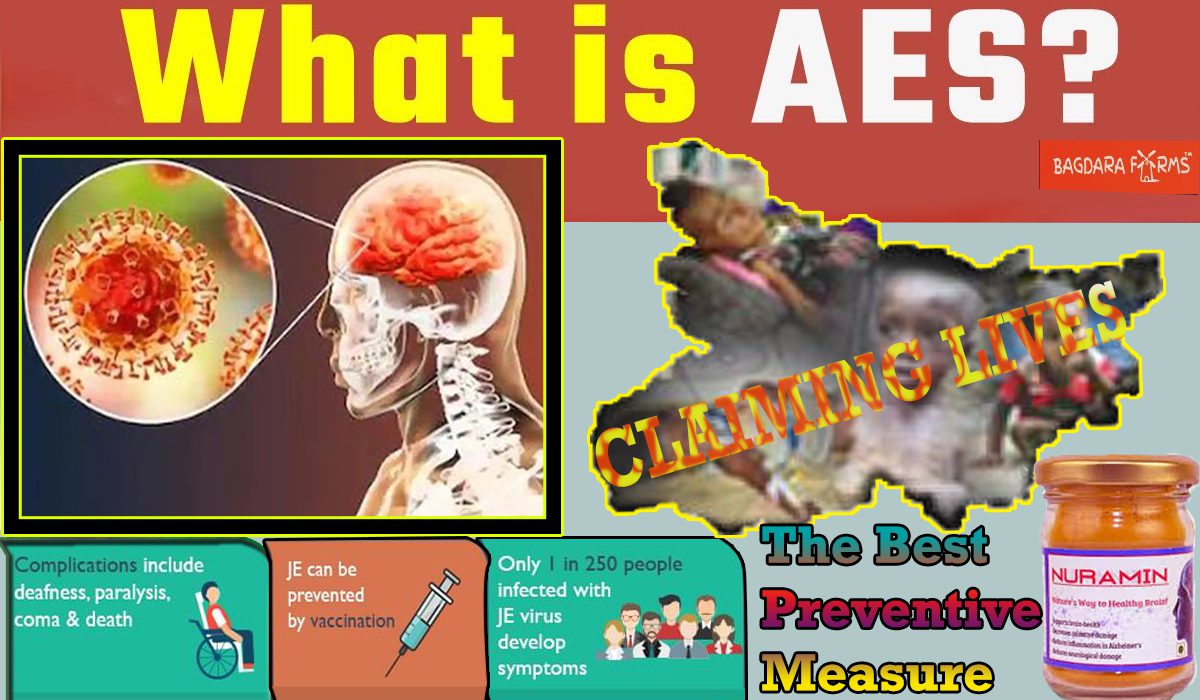 Acute encephalitis syndrome (AES)