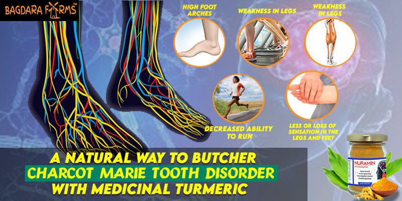 Butcher charcoat marie tooth disorder with Nuramin