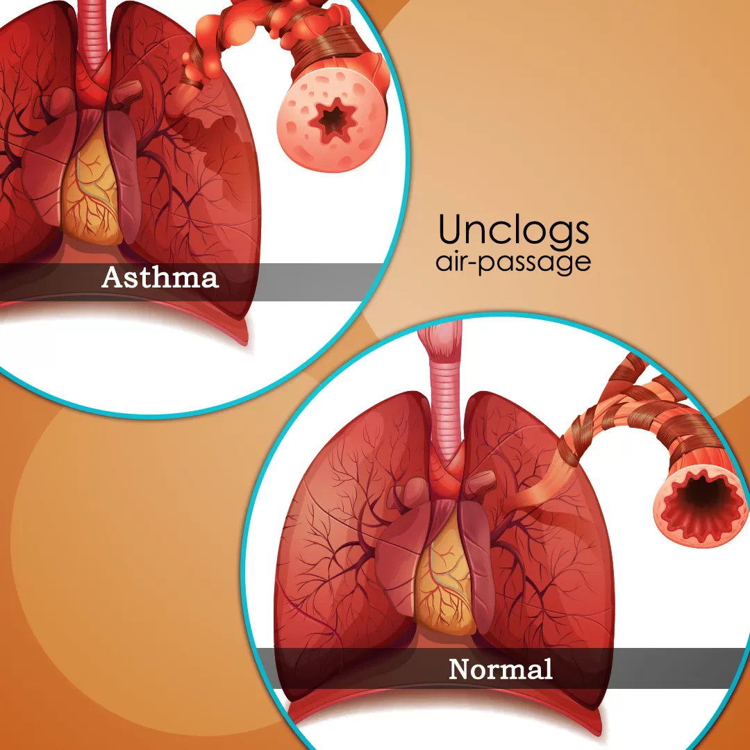 Healthy Lungs And A Clear Respiratory Tract With ASTHUMIN