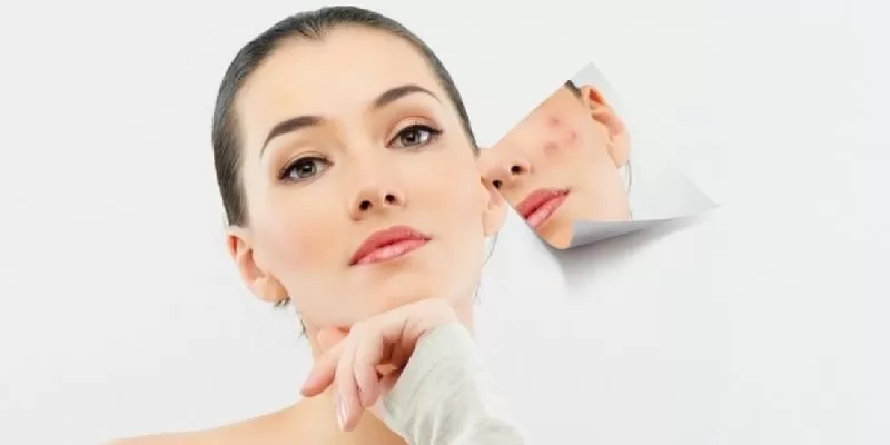 Defy Age with Dermaturm