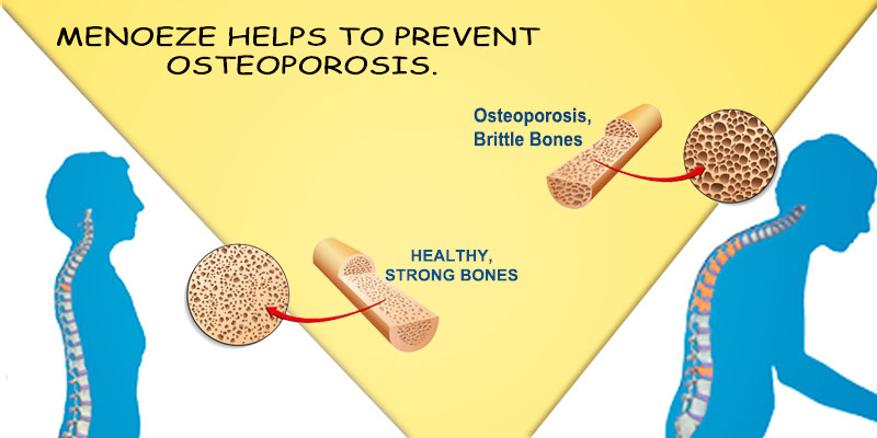 Menoeze helps in osteoporosis