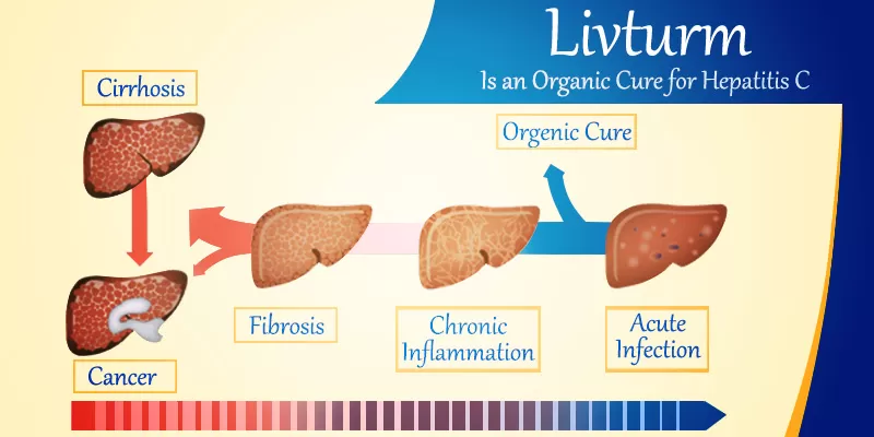Hepatitis C – The Silent Killer