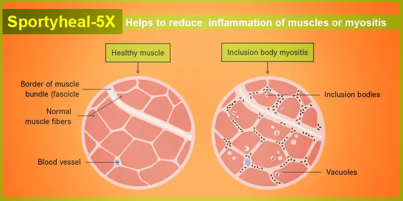 Say No to Muscle Inflammation