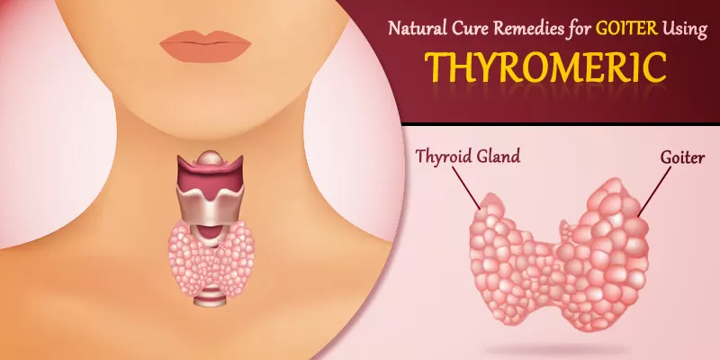 How curcumin helps in treating Goiter