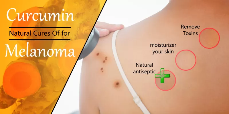 Dermaturm to Prevent Melanoma
