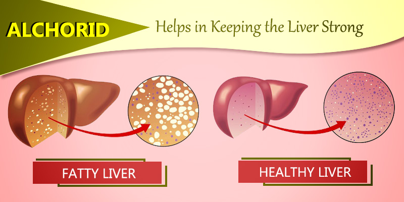 Fight Fatty liver with Alchorid