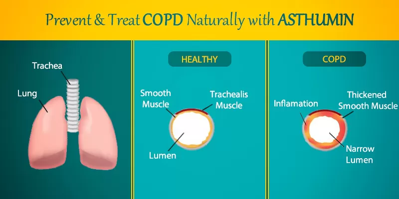 Asthumin for preventing lung diseases