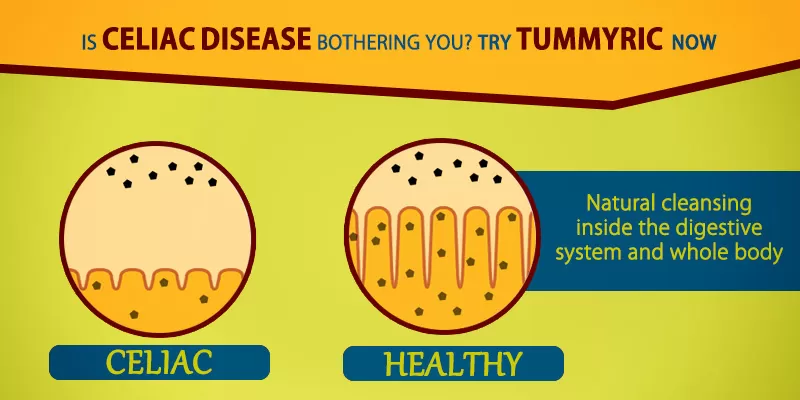 Is celiac disease bothering you? try curcumin now