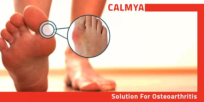 Calmya Helps To Calm And Soothe The Sore Joints
