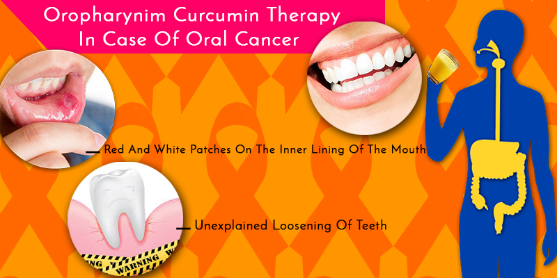 Beating the specter of oral cancer with curcumin
