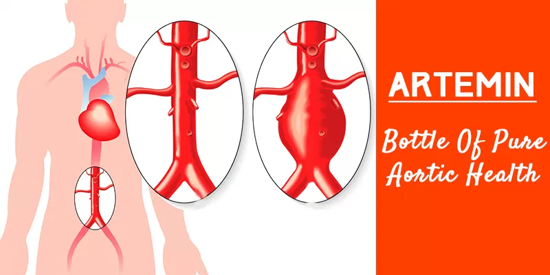 Abdominal Aortic Aneurysm Treatment with Artemin