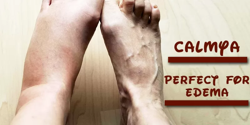 edema cure with Calmya