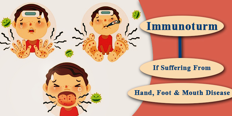 Hand, Foot and Mouth Disease cure with Immunoturm