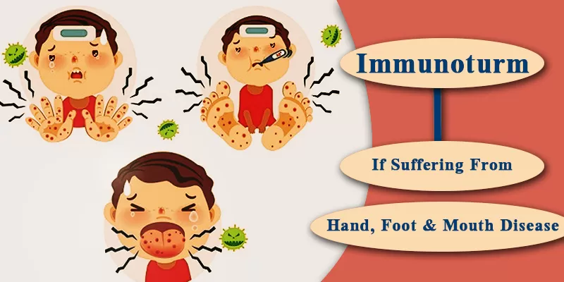 Hand, Foot and Mouth Disease cure with Immunoturm