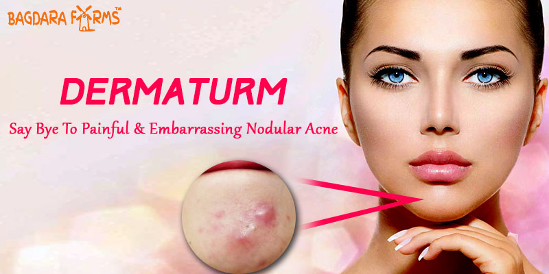 Dermaturm for nodular acne treatment