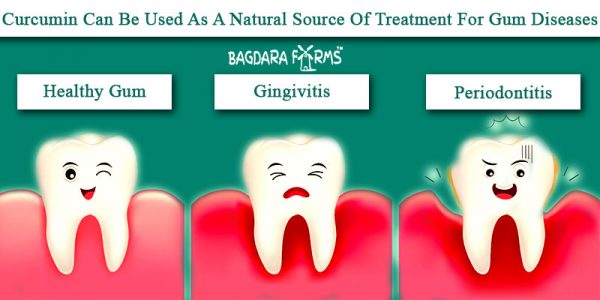 Get Rid of Gingivitis with Curcumin