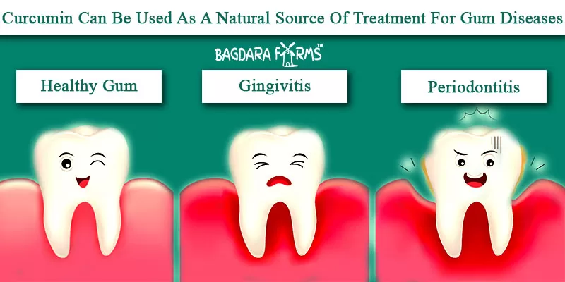 teeth whitening oromin