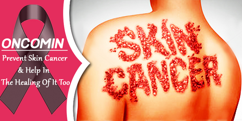 treat skin cancer with oncomin