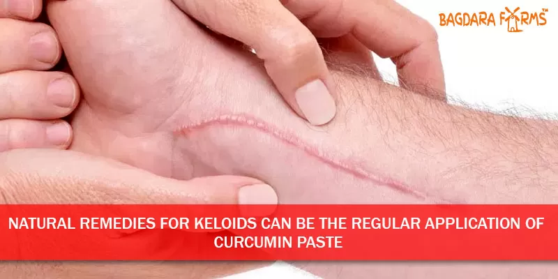 Cure Keloids Problem with Curcumin