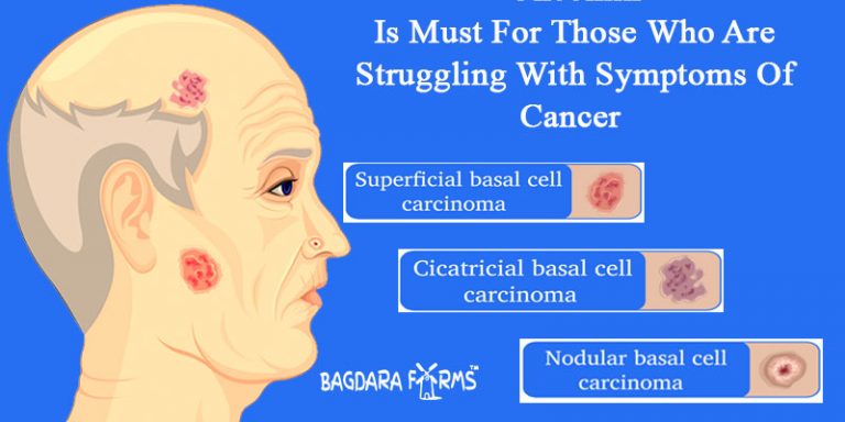 Basal Cell Carcinoma Enhancing Its Treatment With Curcumin 6010