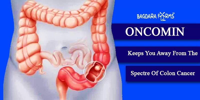 colon cancer , oromin , colon cancer