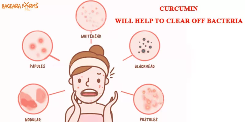 Get Rid Of Acne Naturally With Curcumin