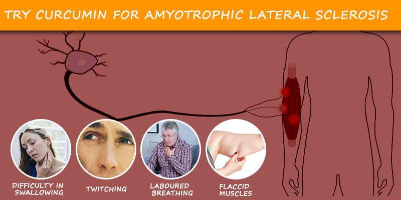 treat Amyotrophic Lateral Sclerosis with nuramin