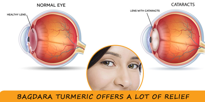 cataract relief with Selfieme-10x