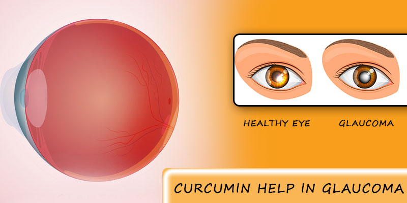 Glaucoma treatment with turmeric