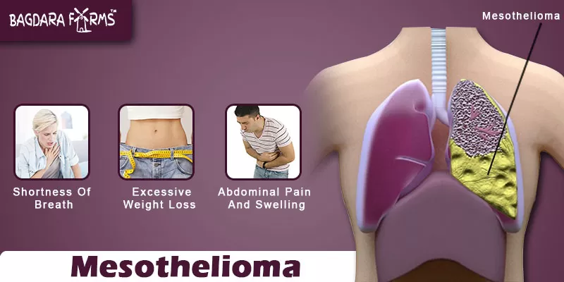 Treat Mesothelioma with Curcumin