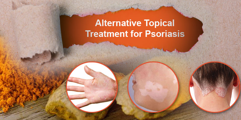 Prevention of Psoriasis with dermaturm