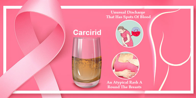 Preventing Breast Cancer with Caricid