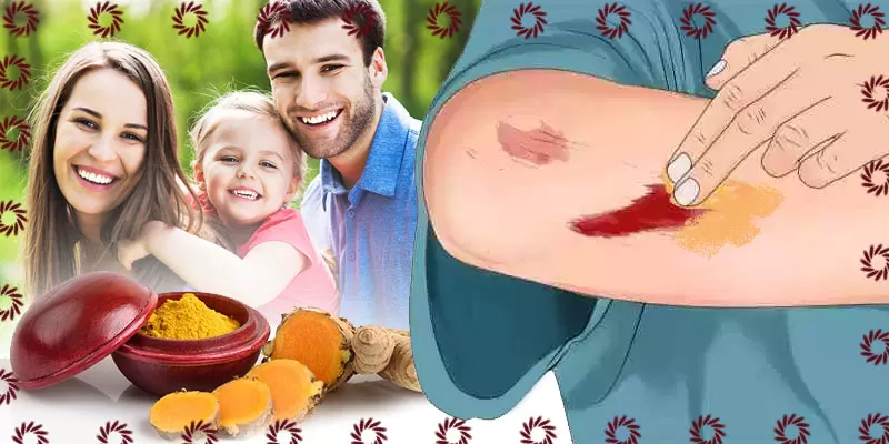 turmeric for wounds