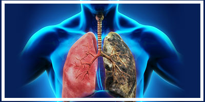 lungs treated for cough