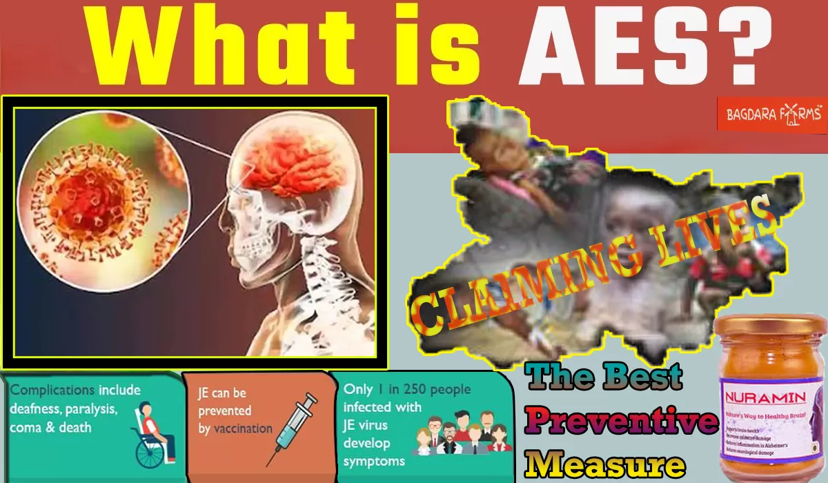 Acute encephalitis syndrome (AES)